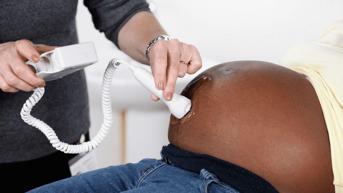 Pregnancy Ultrasound